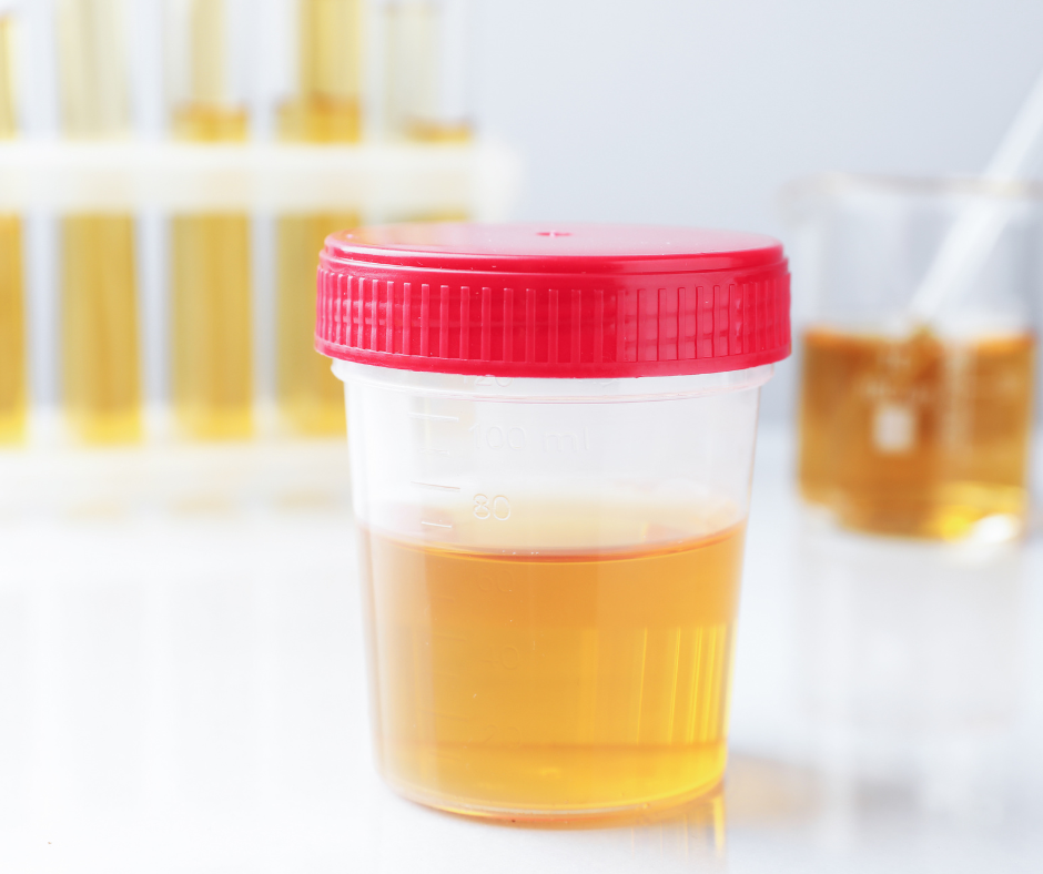 urine